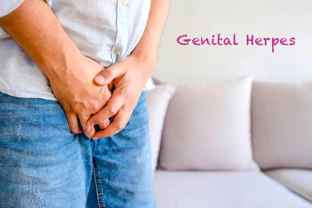 Herpes xəstəliyinin tam müalicəsi