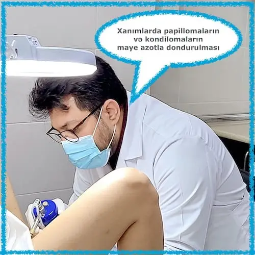genital ziyillərin krioterapiya ilə müalicəsi