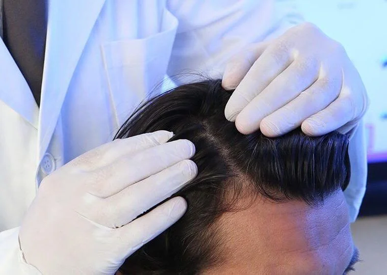 dermatoloq trixoskopik müayinə edir